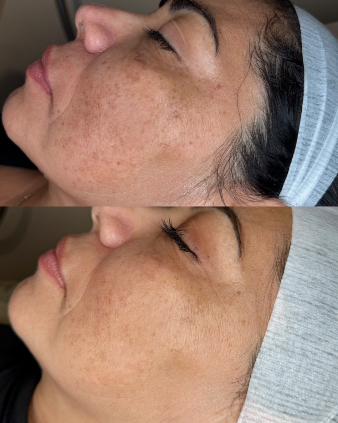 Cell Renew Instagram post 4