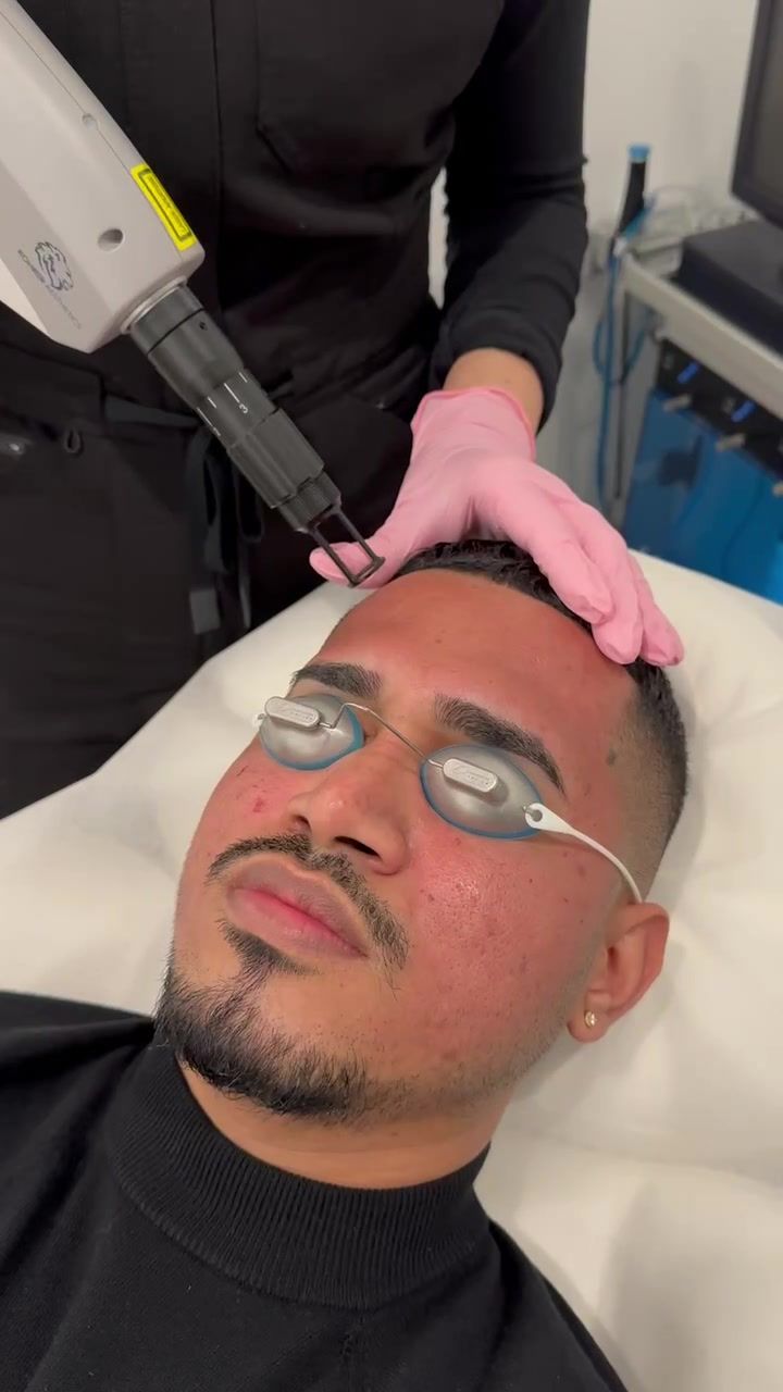 Skin Rejuvenation with Phoenix CO2